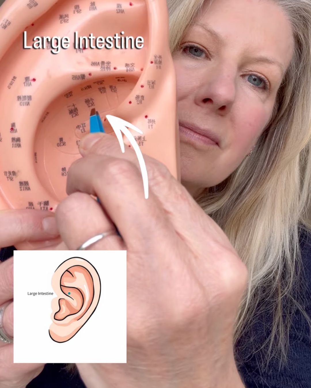 ear map of large intestine