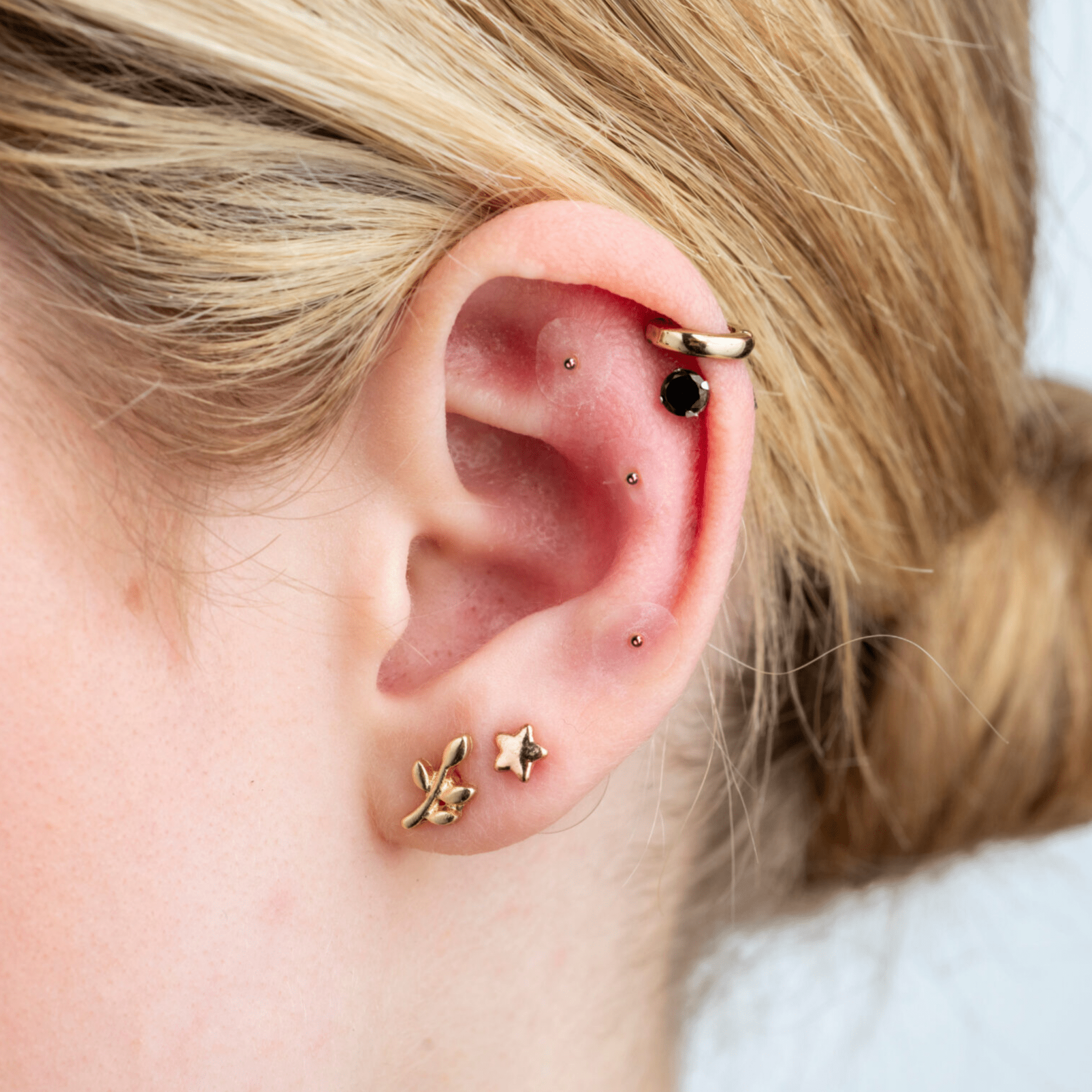 Ear Seeds For Allergies